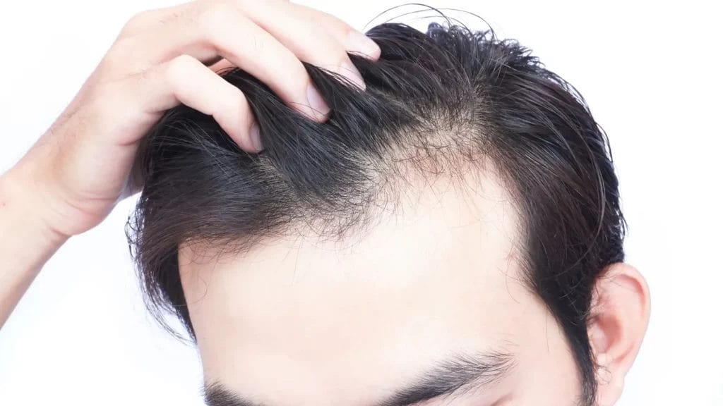 علاج تساقط الشعر للرجال والنساء